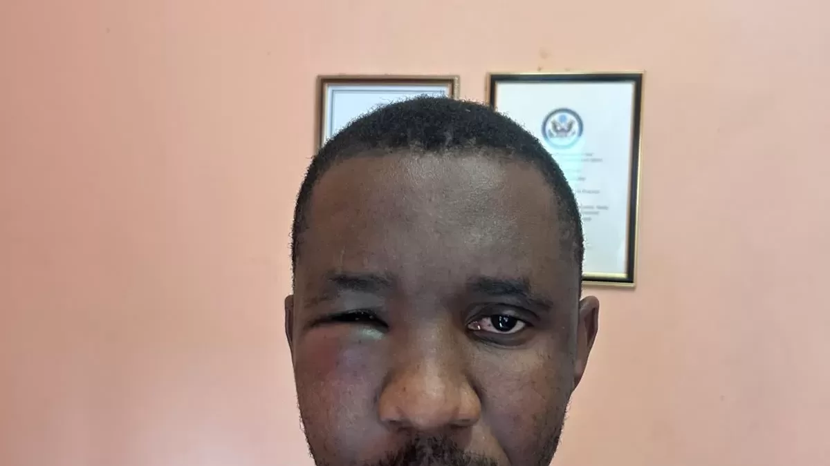 Journalist Kananelo Boloetse abducted and tortured near Thaba-Bosiu