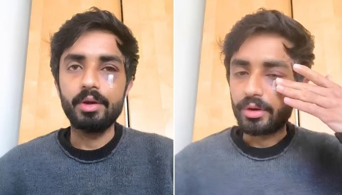 Pakistani student suffers facial fractures in racist attack in Glasgow