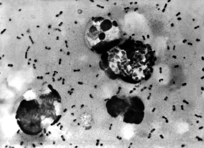 What is pneumonic plague and how dangerous is it?